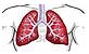 COPD